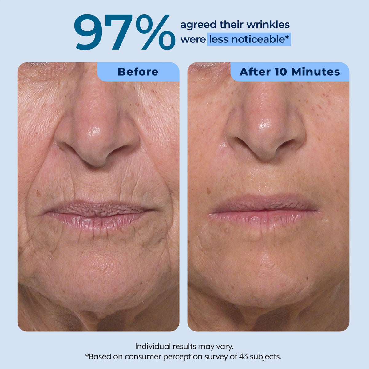 Rapid Reduction Serum – 1-Month Supply Plexaderm®
